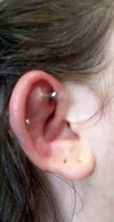 We did not find results for: Woman Had To Have Emergency Surgery After Piercing Got Infected Leaving Her With A Deformed Ear