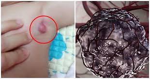9 triệu chứng 'điển hình' báo hiệu trẻ nhỏ bị u ng th ư giai đoạn đầu: Mẹ  đưa con đến viện ngay 👇👇