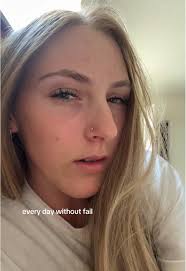 Being Vulnerable About Acne and Skincare