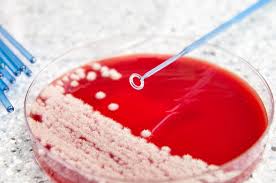 Terapia ar trebui să fie integrate și ajustate individual. Candida Produce Candidoza Vaginala Aftele Bucale Iritatia De Scutec Si Nu Numai Institutiimedicale Ro