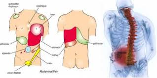 Pin On Scoliosis Back