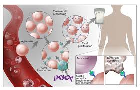 Image result for Hematologic Cancer