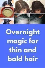 Overnight Magic For Thin And Bald Hair If You Are Suffering From Thin And Bald Hair This Post Is Only For Y Hair Mask For Growth Bald Hair Thick Hair Remedies
