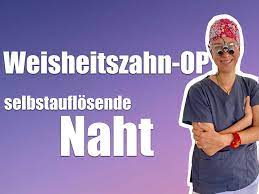 Etwa eine woche nach dem eingriff kontrolliert der arzt die wunde durch den weisheitszahn. Wann Losen Sich Die Faden Nach Der Weisheitszahn Op Auf