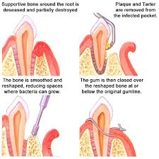 Was there a particular clinical experience or patient encounter that inspired you to create this tool for clinicians? 94 Dental Studies Ideas Dental Dentistry Dental Life