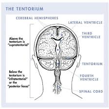 Seizure is the most common symptom in children. Neuropsychiatry Aspects Of Childhood Cranial Tumours Intechopen