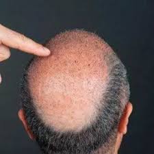 Insula iubirii, sezonul 5, cel mai fierbinte reality show antena 1. Insula Iubirii Sez 4 Ep 11 7 Octombrie 2018 Online