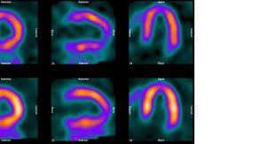Imaging Technology News