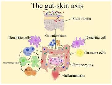 The physiological pathway connecting gut microbiota to skin barrier function., AI generated
