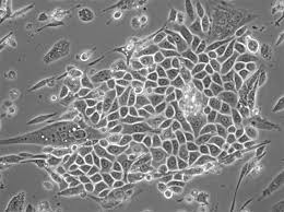 Immortalized keratinocyte lines derived from human embryonic stem cells |  PNAS