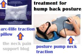 Being mindful of your posture at all times and staying active—keeping your back, core, and neck. Is It Possible To Get Rid Of The Hump On My Neck Neck Pain Support Blog