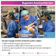 Ust Goz Kapagi Estetik Ameliyat Sunlari Saglar 1 Daha Estetik Ve Genc Goz Cevresi 2 Goz Kapaklarindaki Agirlik Hissinden Kurtulma Gencler Estetik Agirliklar