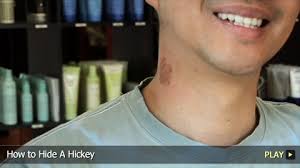 How to hide a hickey without makeup. How To Hide A Hickey Watchmojo Com