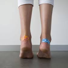 Prurit (mancarime) sau senzatia de arsura la nivelul piciorului. Ce AfecÅ£iuni Pot Ascunde BÄƒsicile De Pe Piele