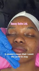 @Sassy Suite Ltd. Deep Cleansing Facial & Consultation #spaday #facial  #trinidadfacials