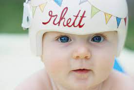 Cranial Band Helmet Doc Band Painting By Leigh Gibson Deanna Devine Photography