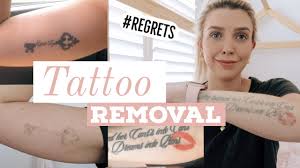 Remocion de tatuajes por método laser la forma mas rápida y segura de remover tatuajes ya no deseados. Laser Tattoo Removal Before After Best Laser Cost Pain And Why I M Removing Them Youtube