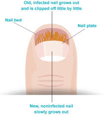 So the time for a partial nail to fully regrow will depend on the amount of nail remaining. How Long Does It Take For Your Nails To Grow Back After Gel Nails New Expression Nails
