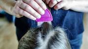Lice In Blonde Hair