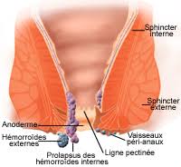 X commence à être contagieux environ trois jours après la contamination, soit autour du mercredi. Les Hemorroides Nancy Gastro