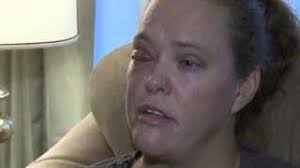 Suspects Sentenced in Beating of Woman Who Lost Eye