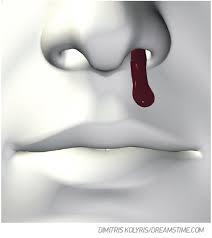Usually, menstrual bleeding lasts about 4 to 5 days and the amount of blood lost is small (2 to 3 tablespoons). When To Worry About Nosebleeds The Pharmaceutical Journal