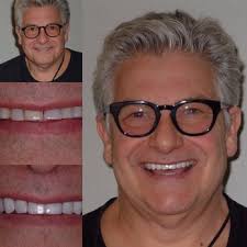 TOP 10 BEST Davinci Teeth Whitening in Miami, FL