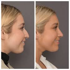 Mr Charles East and Miss Lydia Badia