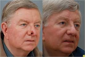 surfkate i london: 2015