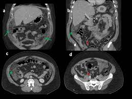 Computed tomography (ct) is considered . Epos Trade