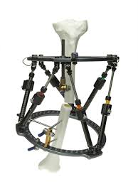 Image result for Multi-Axial System