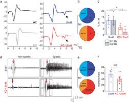 Absence Of Subcerebral Projection Neurons Delays Disease