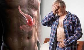 But for many sufferers, pain is not among the disease's early warning signs. Stomach Cancer Symptoms Four Early Signs Of The Disease You Need To Know Express Co Uk