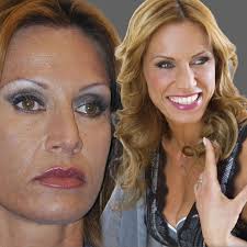 A Napoli stavo uscendo da un portone e avevo studiato il mio percorso:  attraversando verso sinistra, trovavo un angolo e lì c'era la palestra.  Chiamavo una ragazza, Rosalba, e le dicevo: "Sto