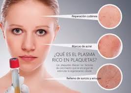 Plasma Rico En Plaquetas Consulta Medica San Francisco Plasma Rico En Plaquetas Marcas De Acne Tarjeta Medica