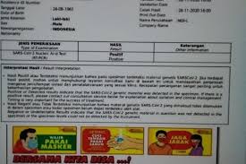 Foto Viral Surat Hasil Swab Positif Covid 19 Rizieq Shihab Akui Sedang Isolasi Mandiri Halaman All Kompas Com