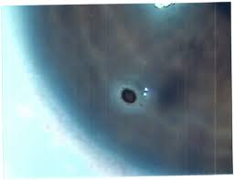 盛岡市の眼科『盛岡南眼科』