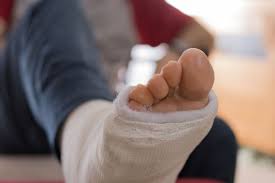 New technique uses muscle that moves the big toe to help aid recovery. What To Expect After Achilles Tendon Surgery Cornerstone Foot Ankle
