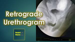 Image result for Retrograde Urethrogram