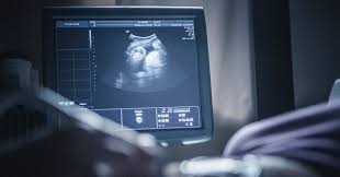 Image result for Ultrasound