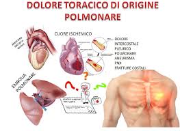 Sono stati effettuati gli accertamenti. Dolore Toracico Di Origine Polmonare