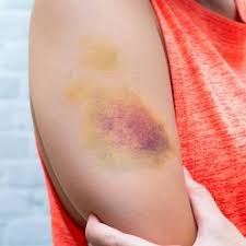La mycose vaginale est une vraie source d'inconfort. Mycose Vaginale Comment S En Debarrasser Au Naturel Beaute Cherie
