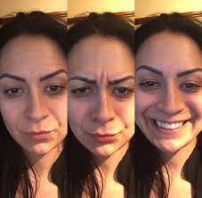 Wellness concerns including hair fall, acne, and gut health