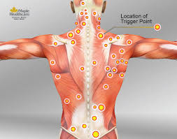 Image result for Trigger Point Location