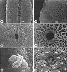 Image result for Hedythyrsus thamnoideus