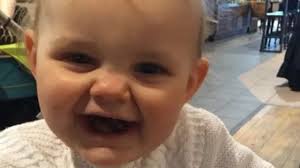 Elsie Scully-Hicks 'high rickets' risk hears murder jury