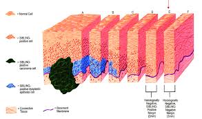 But he did get it all. Schematics Illustration Of Tumor Margin Estimation With Siblings And Download Scientific Diagram
