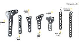 VariAx 2 Distal Radius and Distal Ulna | Stryker