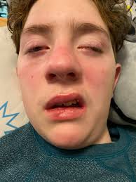 I'm sick again, honey 😔💔