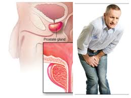 Throat cancer can cause pain or a burning sensation when chewing and swallowing food. Prostate Cancer Symptoms Tamil Reeducation Perineale